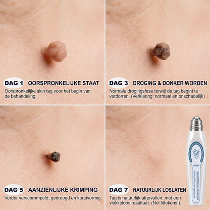 🎁🎁 Hiskin® heeft speciaal voor jou nóg een verrassing! Je had al een geweldige aanbieding, maar nu heb je een nóg betere deal vrijgespeeld: maar liefst 50% KORTING op je volgende aankoop!