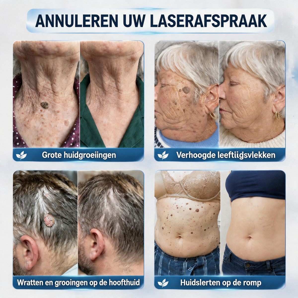 🎁🎁 Hiskin® heeft speciaal voor jou nóg een verrassing! Je had al een geweldige aanbieding, maar nu heb je een nóg betere deal vrijgespeeld: maar liefst 50% KORTING op je volgende aankoop!