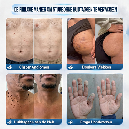 🎁🎁 Hiskin® heeft speciaal voor jou nóg een verrassing! Je had al een geweldige aanbieding, maar nu heb je een nóg betere deal vrijgespeeld: maar liefst 50% KORTING op je volgende aankoop!